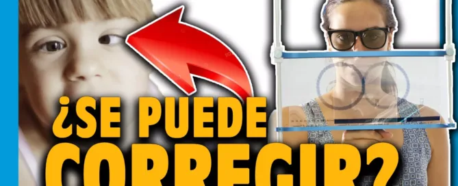 terapia visual en el estrabismo